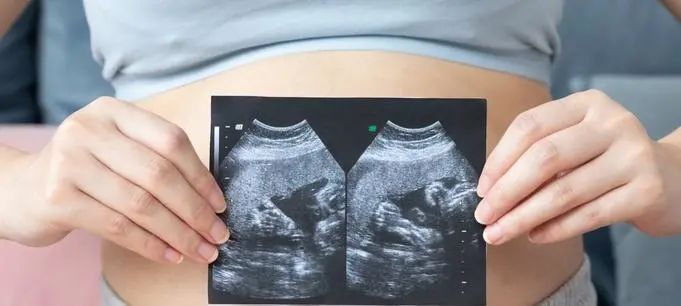 怀孕8个月哪里有做亲子鉴定吗？