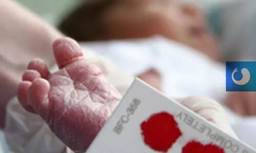 親子鑒定可以自己采樣嗎？看著里！