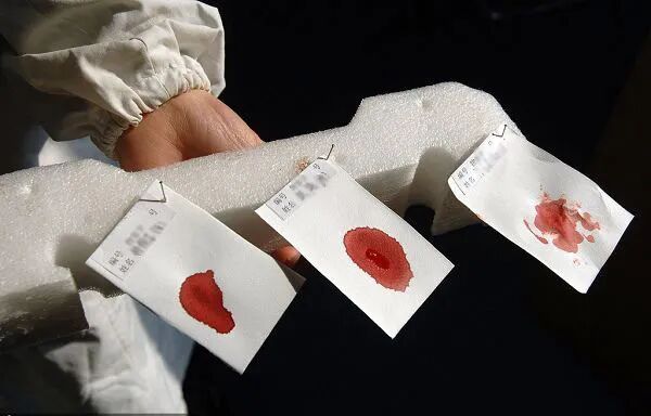 上户口亲子鉴定需要的材料