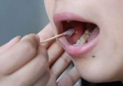 个人做亲子鉴定需要什么样本？看着里！