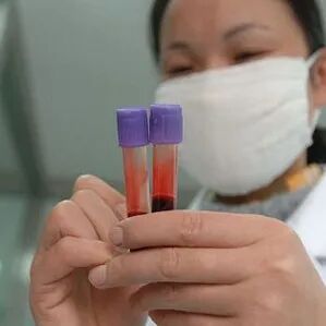 产前隐私孕妇静脉血亲子鉴定？