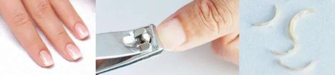 亲子鉴定能用指甲做样本吗？看这里!