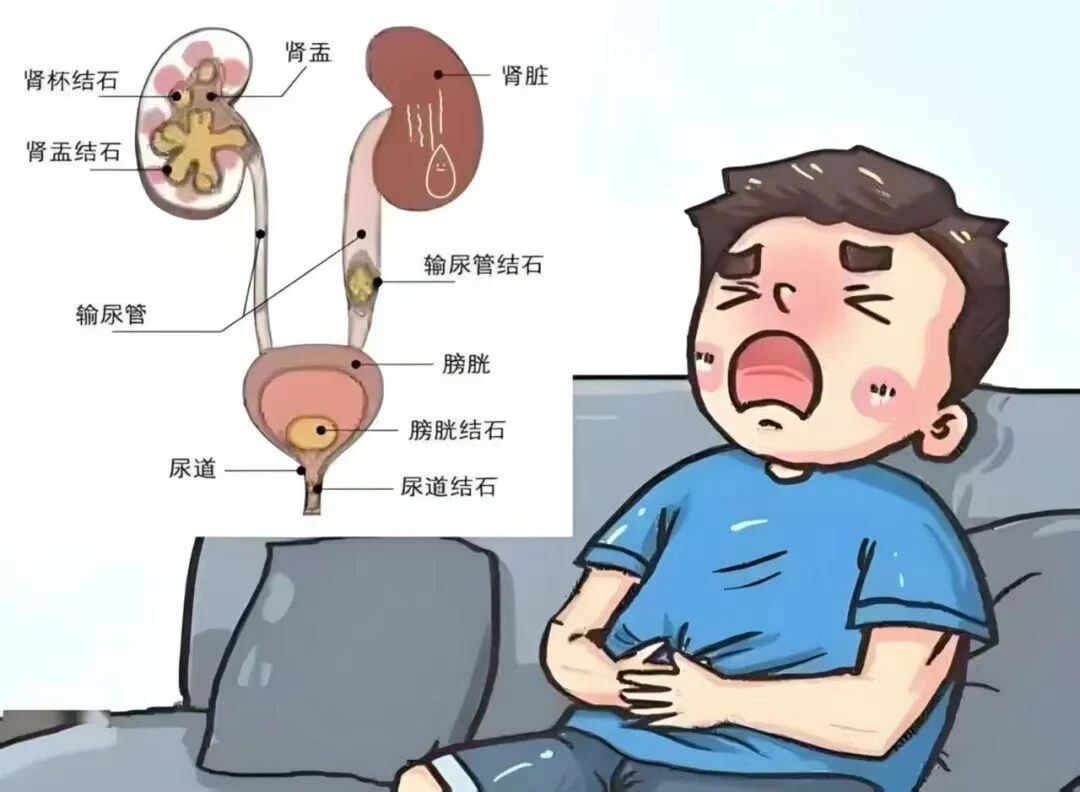 体外碎石b超怎么定位【智能双定位碎石+立体振动排石】鄯善县人民医院超强“祛结石CP”投入使用