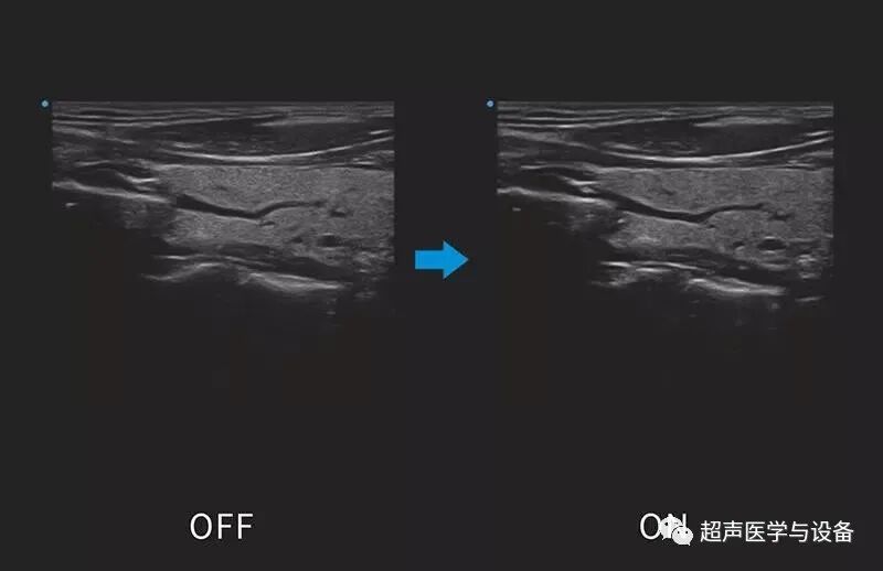 siui彩超怎么用第84届CMEF超声厂家“群英会”---汕头超声：中国超声行业的“老大哥”_https://www.jmylbn.com_新闻资讯_第32张