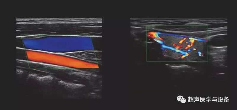 siui彩超怎么用第84届CMEF超声厂家“群英会”---汕头超声：中国超声行业的“老大哥”_https://www.jmylbn.com_新闻资讯_第34张