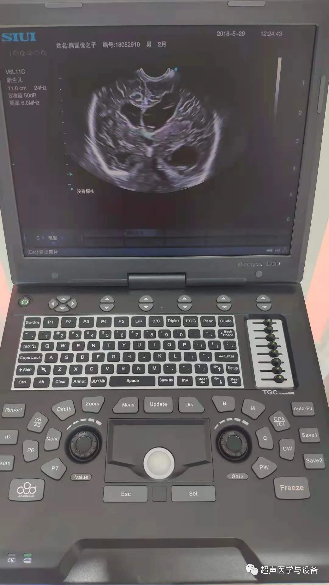 siui彩超怎么用第84届CMEF超声厂家“群英会”---汕头超声：中国超声行业的“老大哥”_https://www.jmylbn.com_新闻资讯_第6张