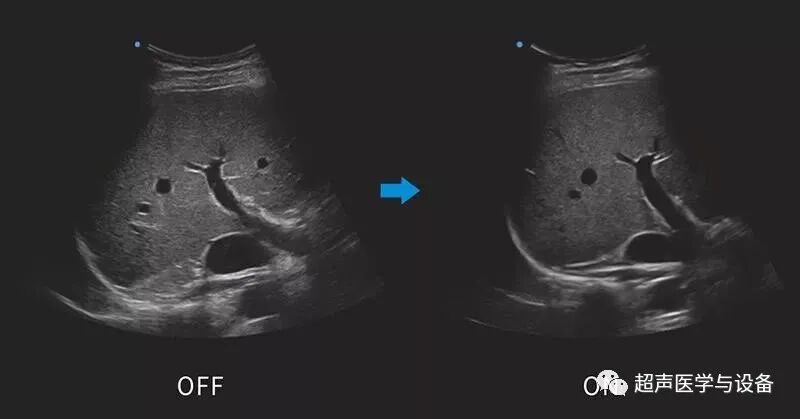 siui彩超怎么用第84届CMEF超声厂家“群英会”---汕头超声：中国超声行业的“老大哥”_https://www.jmylbn.com_新闻资讯_第30张