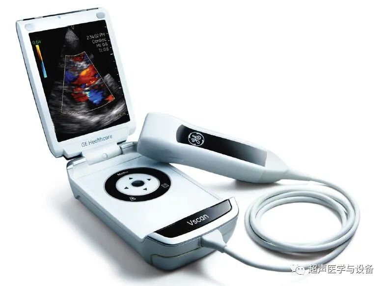 索诺星超声怎么样【一文盘点】市场主流掌上超声_https://www.jmylbn.com_新闻资讯_第2张