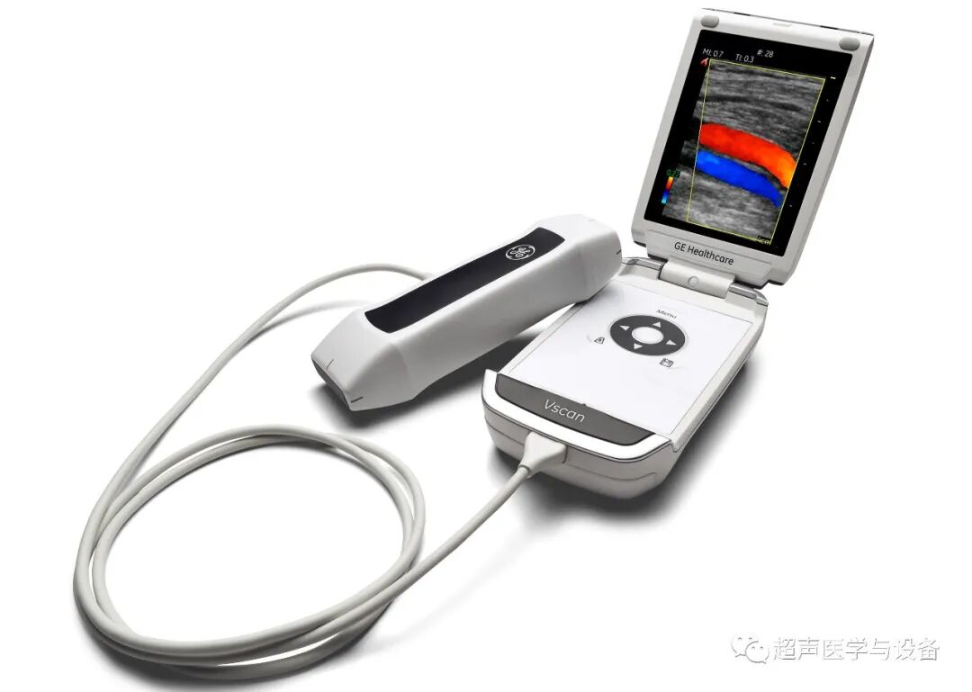 索诺星超声怎么样【一文盘点】市场主流掌上超声_https://www.jmylbn.com_新闻资讯_第3张