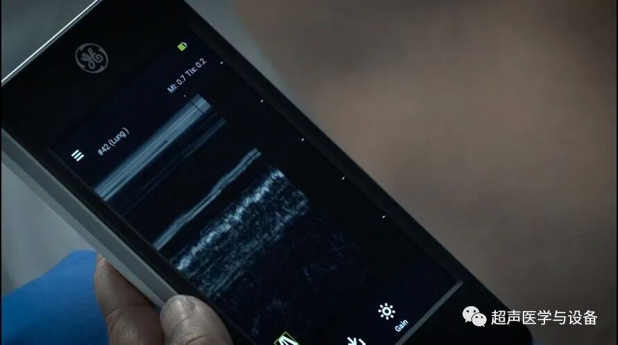 索诺星超声怎么样【一文盘点】市场主流掌上超声_https://www.jmylbn.com_新闻资讯_第9张