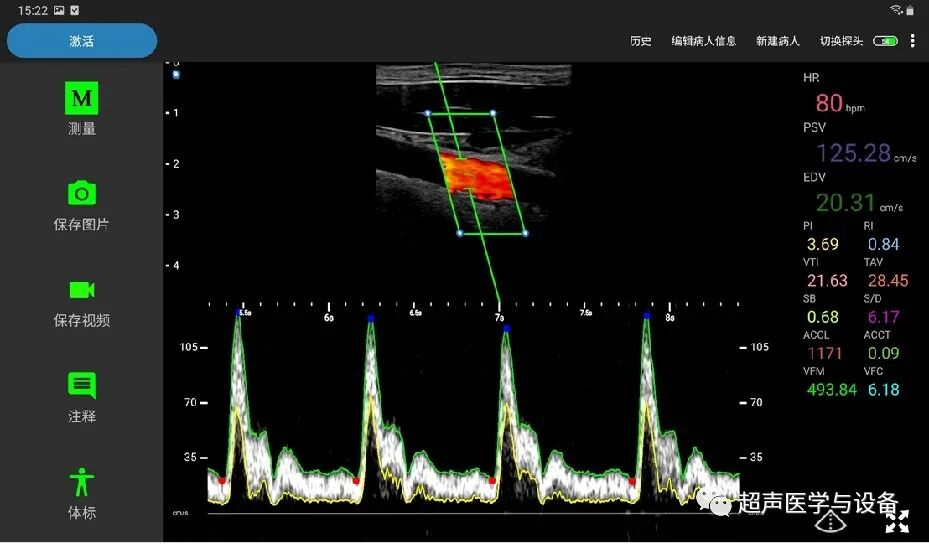 索诺星超声怎么样【一文盘点】市场主流掌上超声_https://www.jmylbn.com_新闻资讯_第21张