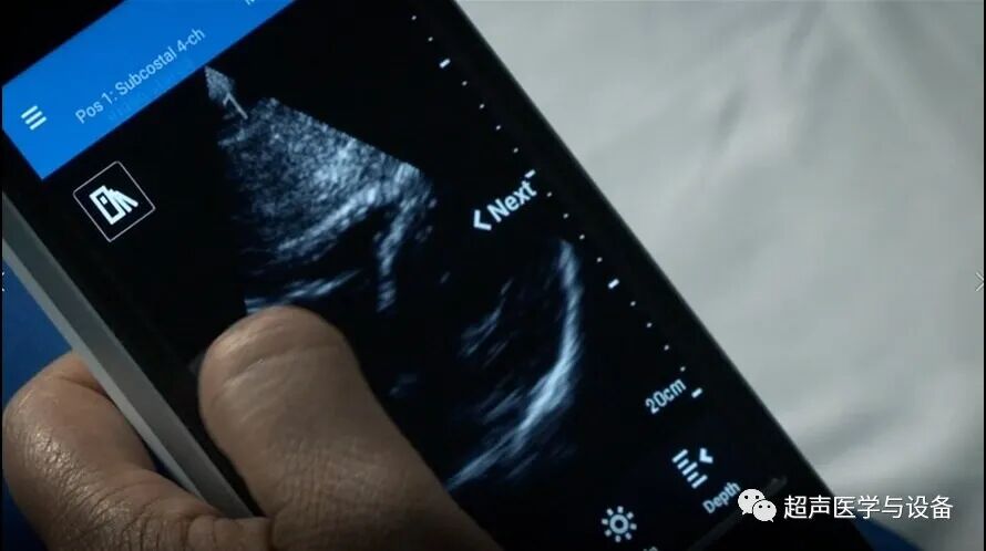 索诺星超声怎么样【一文盘点】市场主流掌上超声_https://www.jmylbn.com_新闻资讯_第8张