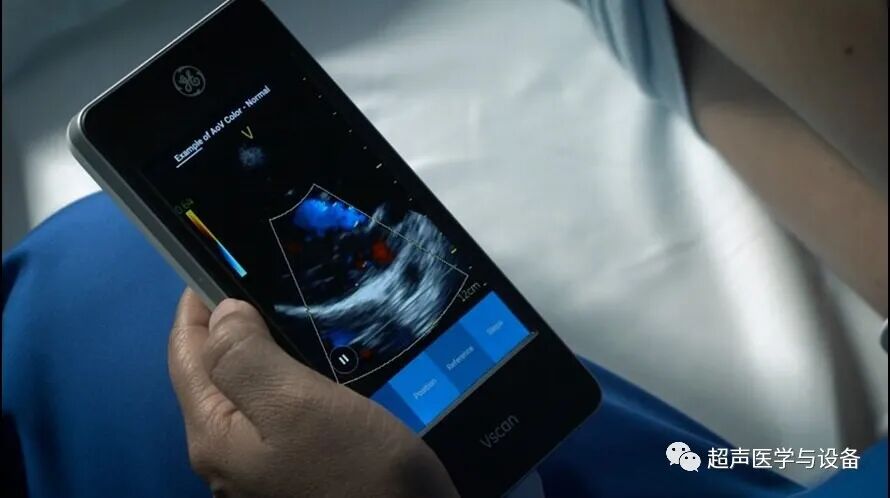 索诺星超声怎么样【一文盘点】市场主流掌上超声_https://www.jmylbn.com_新闻资讯_第11张