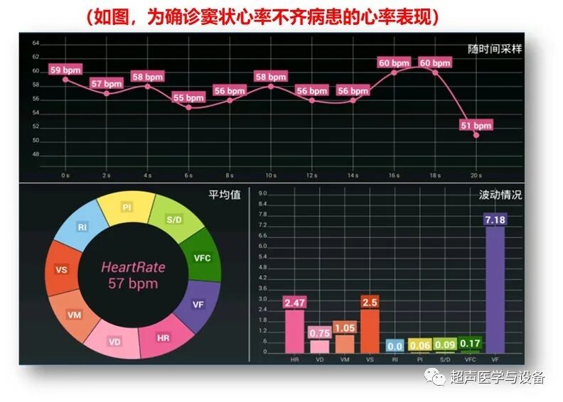 索诺星超声怎么样【一文盘点】市场主流掌上超声_https://www.jmylbn.com_新闻资讯_第22张