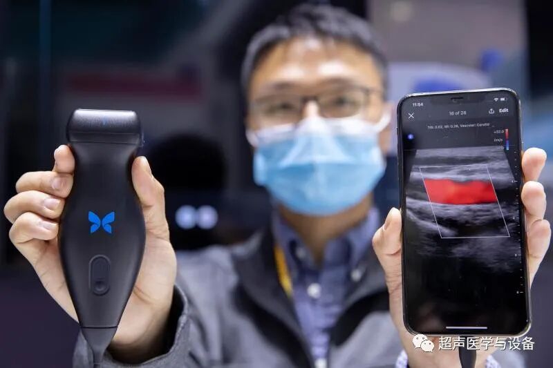 索诺星超声怎么样【一文盘点】市场主流掌上超声_https://www.jmylbn.com_新闻资讯_第29张