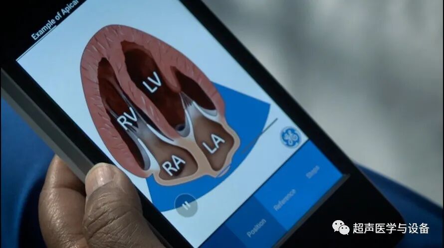 索诺星超声怎么样【一文盘点】市场主流掌上超声_https://www.jmylbn.com_新闻资讯_第7张