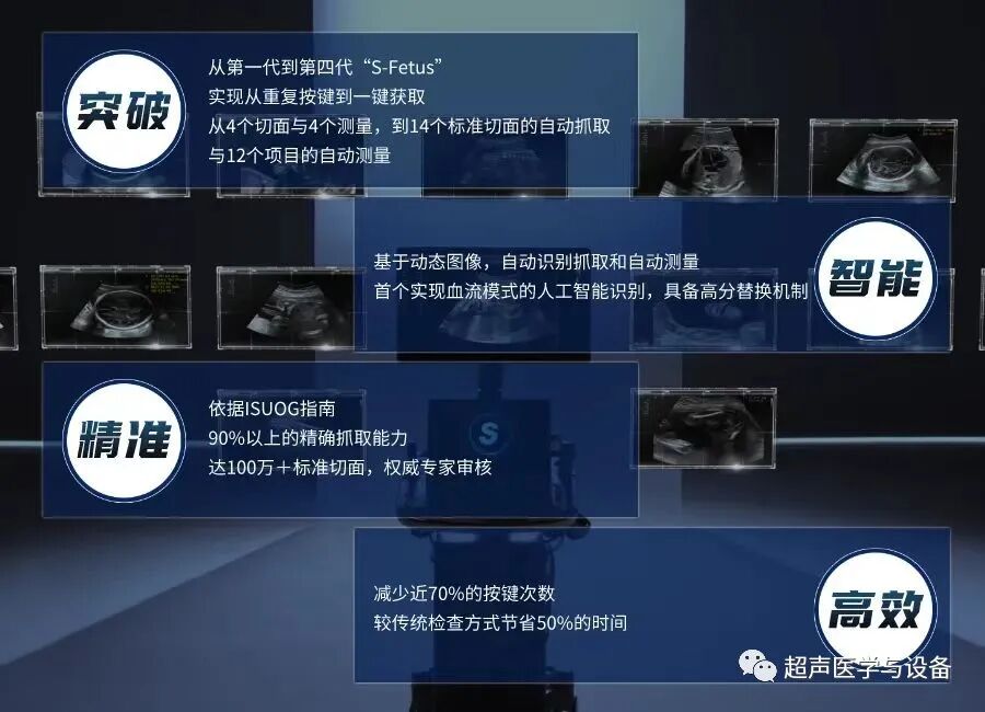 开立超声怎么导出图像借我一双“凤眼”，用AI把产筛纷扰看得真真切切---那个高老师探究彩超功能系列之开立S-Fetus4.0凤眼篇_https://www.jmylbn.com_新闻资讯_第2张
