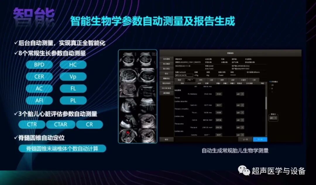 开立超声怎么导出图像借我一双“凤眼”，用AI把产筛纷扰看得真真切切---那个高老师探究彩超功能系列之开立S-Fetus4.0凤眼篇_https://www.jmylbn.com_新闻资讯_第7张