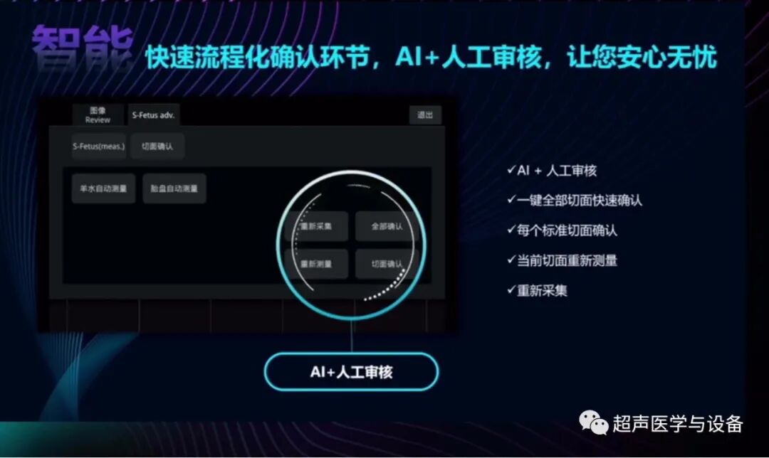 开立超声怎么导出图像借我一双“凤眼”，用AI把产筛纷扰看得真真切切---那个高老师探究彩超功能系列之开立S-Fetus4.0凤眼篇_https://www.jmylbn.com_新闻资讯_第9张