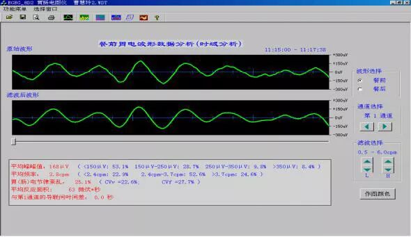 肠电图能查看什么烟台首台“胃肠电图”检测仪 ｜ 胃肠检查更轻松_https://www.jmylbn.com_新闻资讯_第3张
