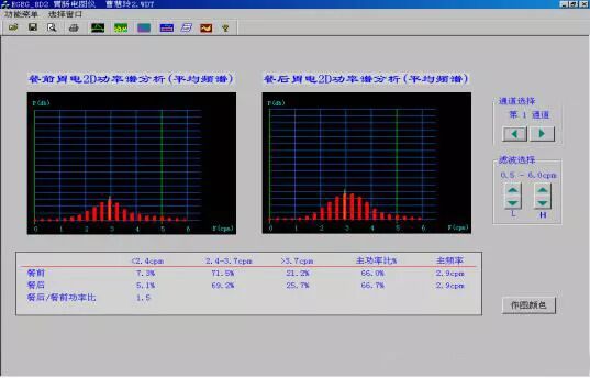 肠电图能查看什么烟台首台“胃肠电图”检测仪 ｜ 胃肠检查更轻松_https://www.jmylbn.com_新闻资讯_第6张