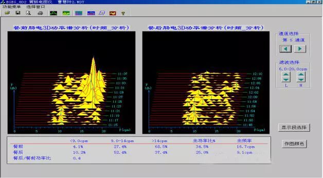 肠电图能查看什么烟台首台“胃肠电图”检测仪 ｜ 胃肠检查更轻松_https://www.jmylbn.com_新闻资讯_第5张