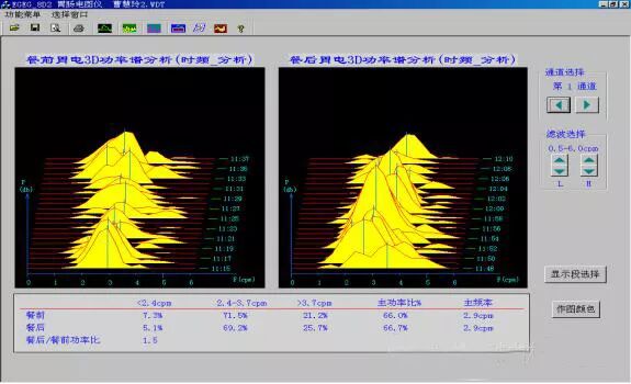 肠电图能查看什么烟台首台“胃肠电图”检测仪 ｜ 胃肠检查更轻松_https://www.jmylbn.com_新闻资讯_第4张