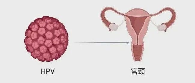 这种病偏爱胸大的女性？得知真相扎心了
