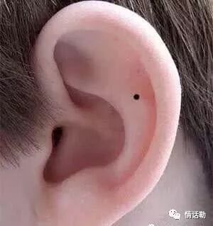 耳朵这些地方有痣 富贵加身 一辈子不差钱 情话勒 微信公众号文章阅读 Wemp