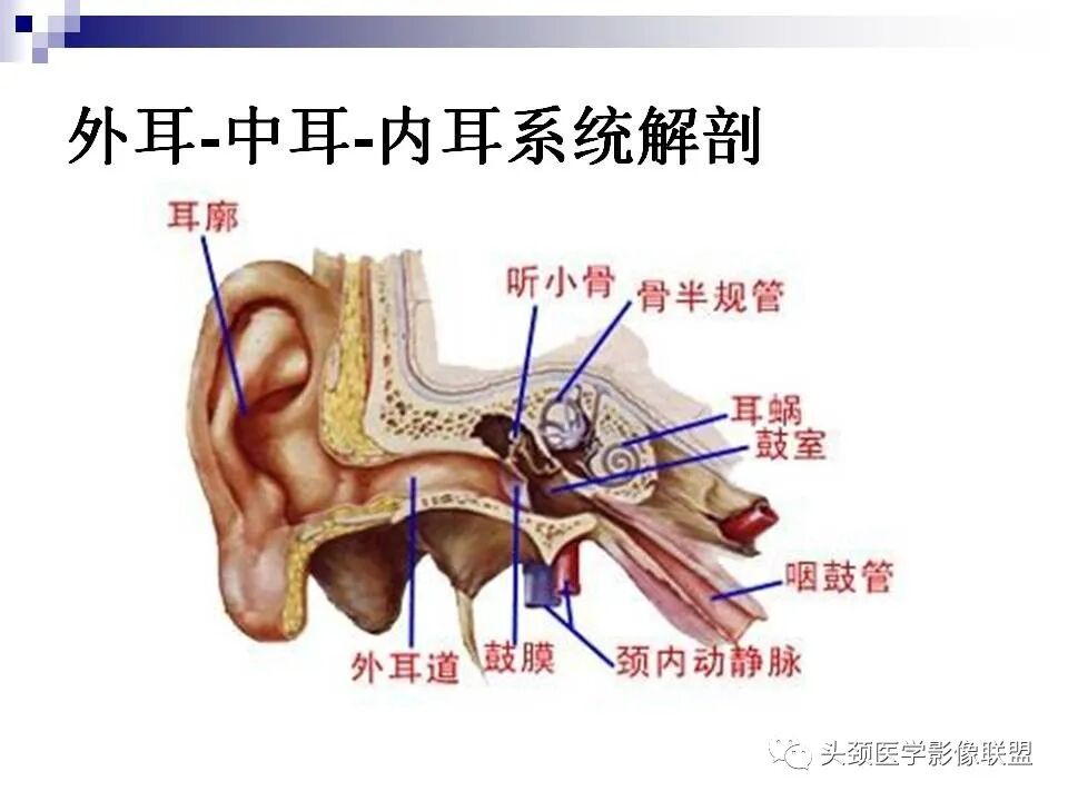 大前庭导水管综合征的影像诊断