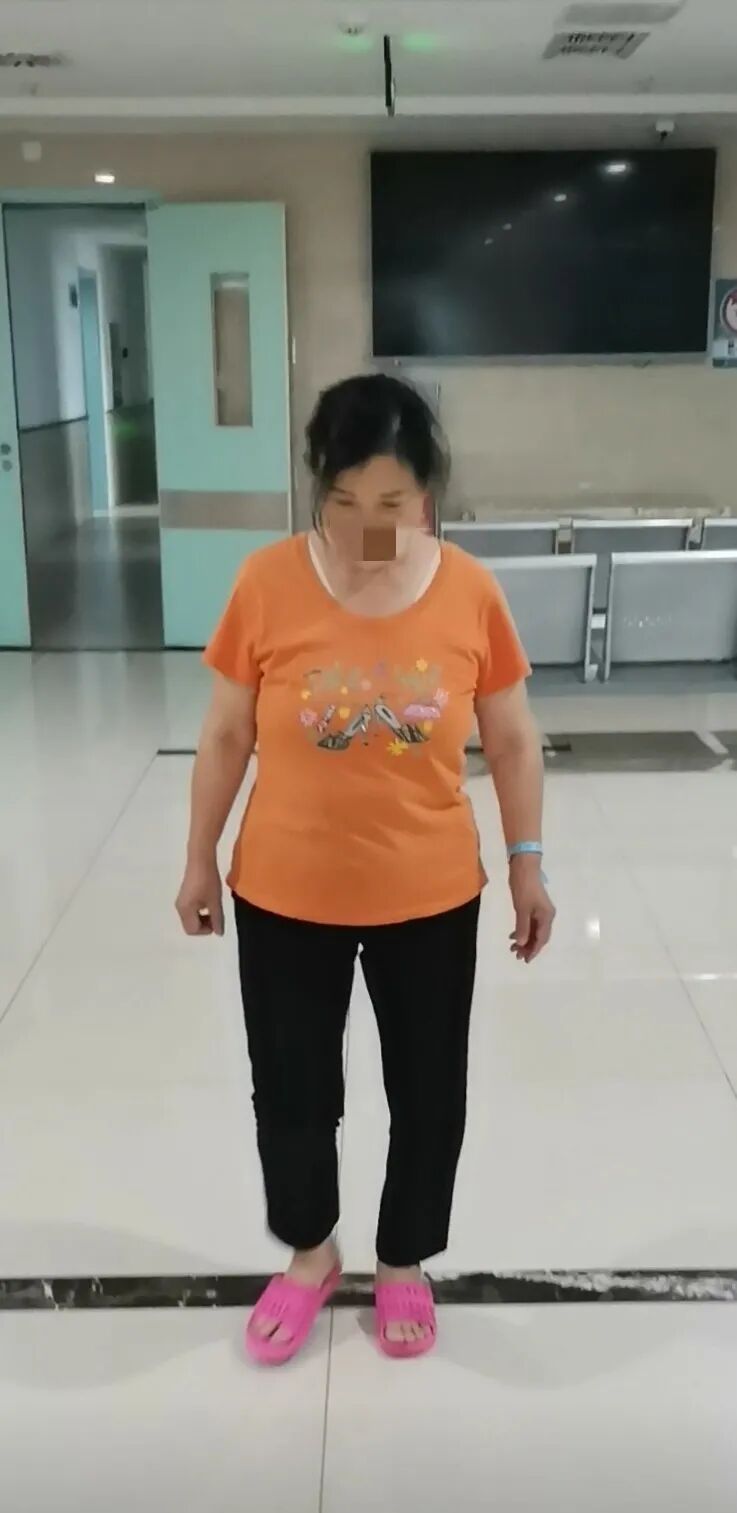 固定膝盖矫正器叫什么膝关节保卫之术——微创矫正修复性手术_https://www.jmylbn.com_新闻资讯_第2张