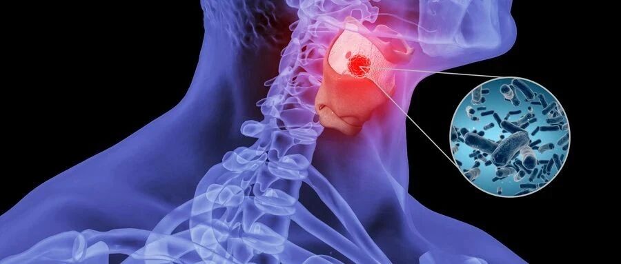 别把喉咙痛当小事，它有时也会要人命!