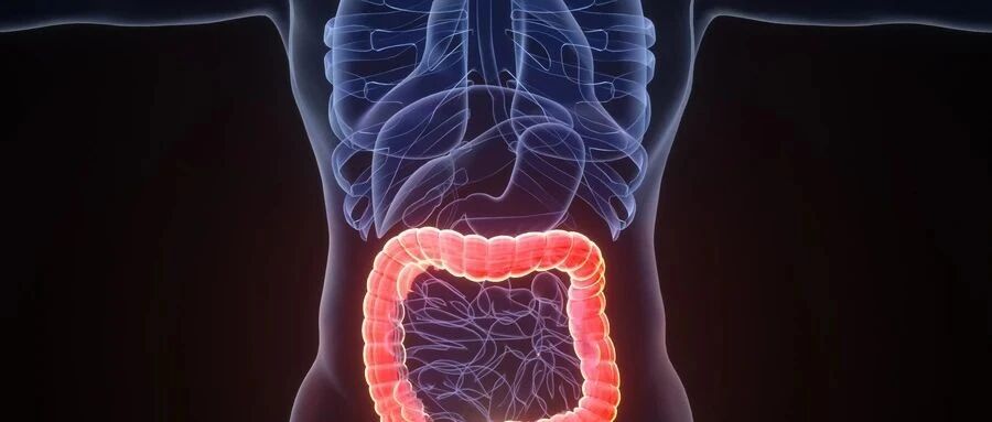 三个月近千例高危人群胃肠镜检查，发现肠癌33例，70%的人有肠息肉……浙大二院将大肠癌筛查的结果做了统计，结果让人震惊