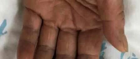 吃了这道菜，杭州两位阿姨都中毒！医生：严重可致死！夏天高发，不少人是它的忠粉...