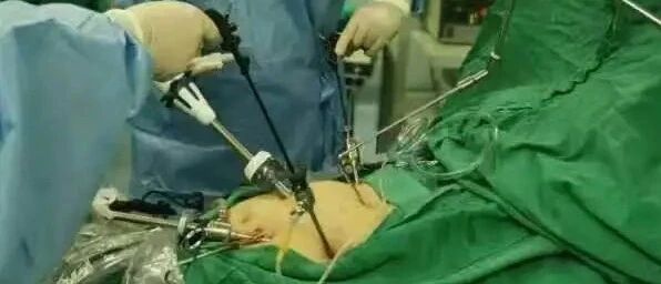 30多岁男子连续两次呼吸衰竭送入ICU抢救，这种致命因素不少人都有