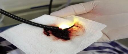 天气转凉，中年妇女咳嗽半月突然咳血！出现这几种情况，一定要及时就医