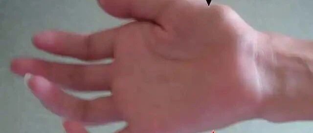 "不会就这样废了吧!"杭州16岁男孩每晚看着自己的手发慌!这个习惯,很多人都有...