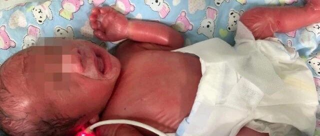 全身“油光光”，像裹着层羊皮纸，皮肤破损、断裂，她生了个“火娃”，万幸的是……