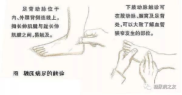 足血管 抗血管生成改善肿瘤微环境在肿瘤免疫治疗中的应用 新浪医药新闻 Amp Petmd Com