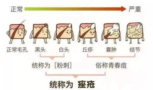 闭口类型图解图片