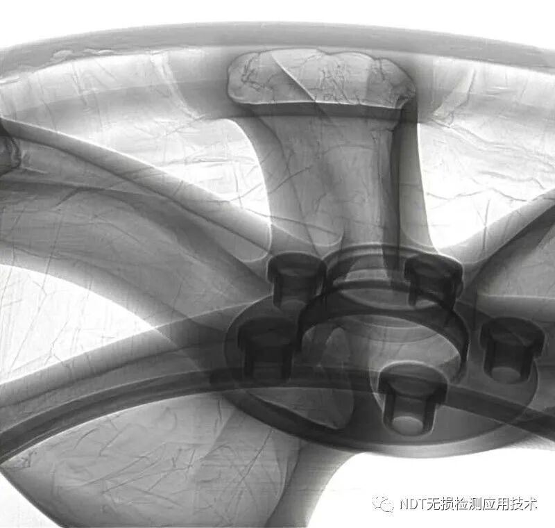 为什么x光片用胶片传统X光胶片成像和X射线数字成像的区别_https://www.jmylbn.com_新闻资讯_第10张