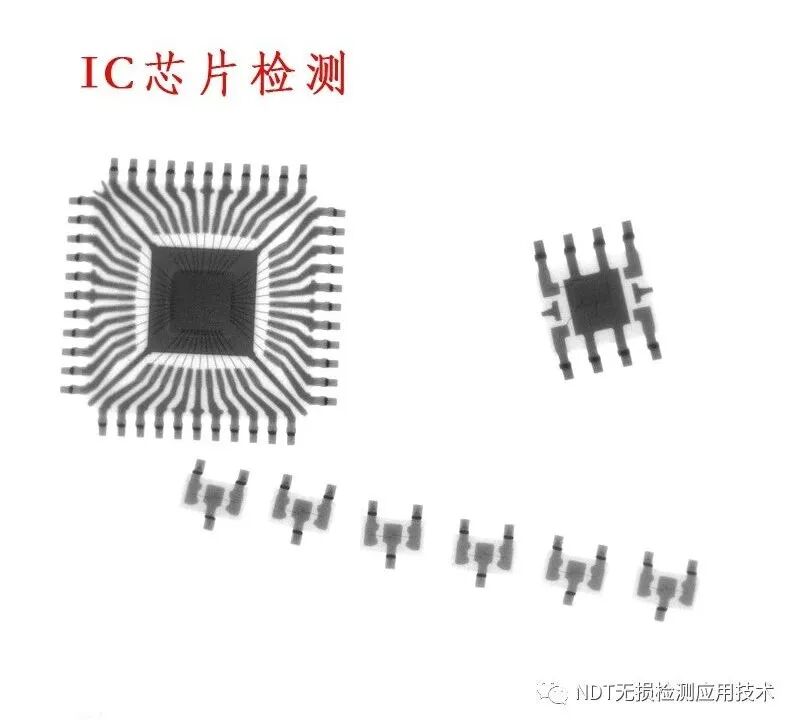 为什么x光片用胶片传统X光胶片成像和X射线数字成像的区别_https://www.jmylbn.com_新闻资讯_第6张