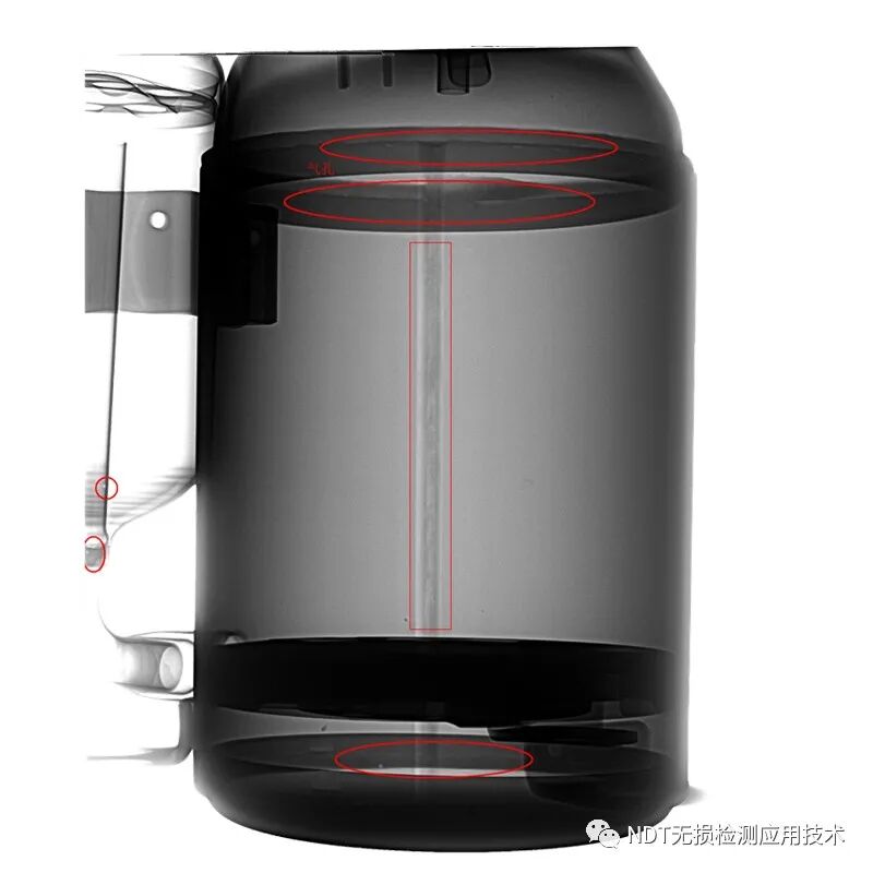 为什么x光片用胶片传统X光胶片成像和X射线数字成像的区别_https://www.jmylbn.com_新闻资讯_第15张