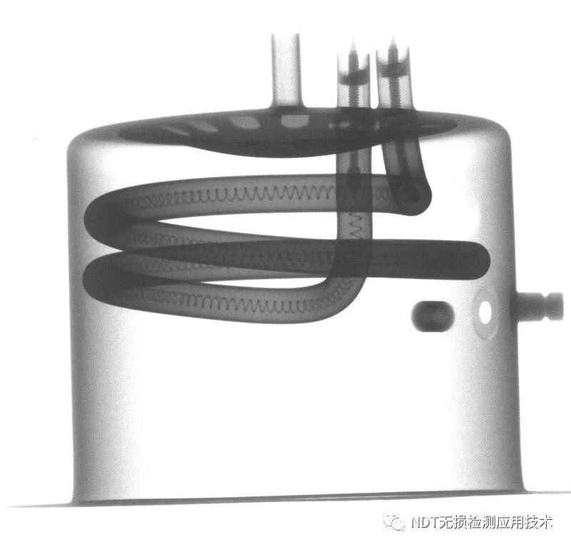 为什么x光片用胶片传统X光胶片成像和X射线数字成像的区别_https://www.jmylbn.com_新闻资讯_第16张