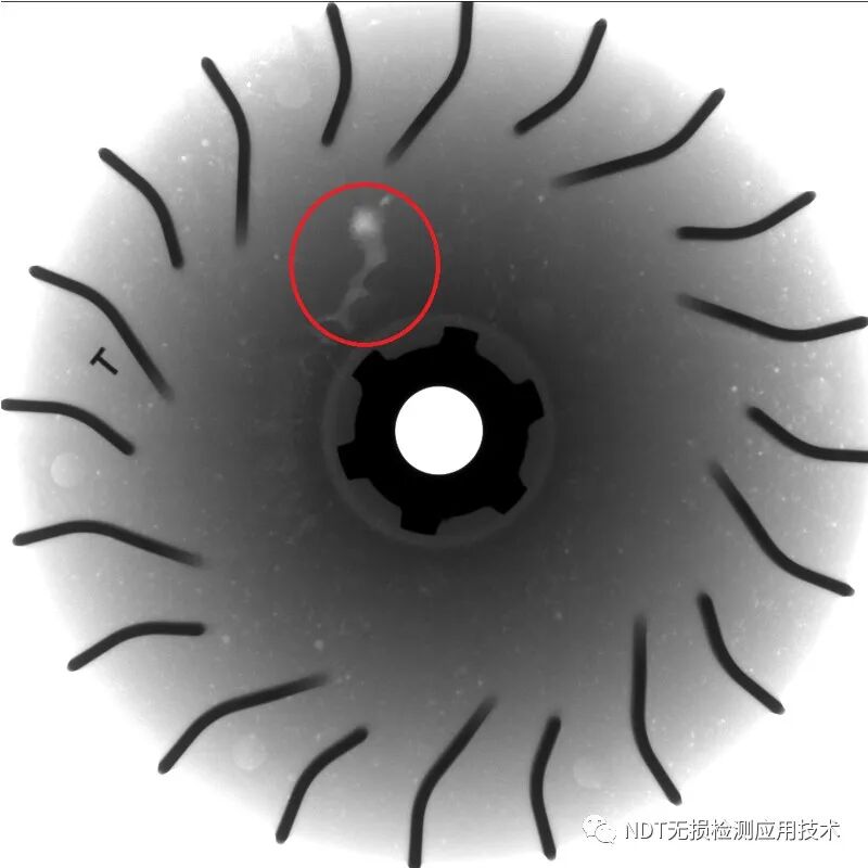 为什么x光片用胶片传统X光胶片成像和X射线数字成像的区别_https://www.jmylbn.com_新闻资讯_第13张