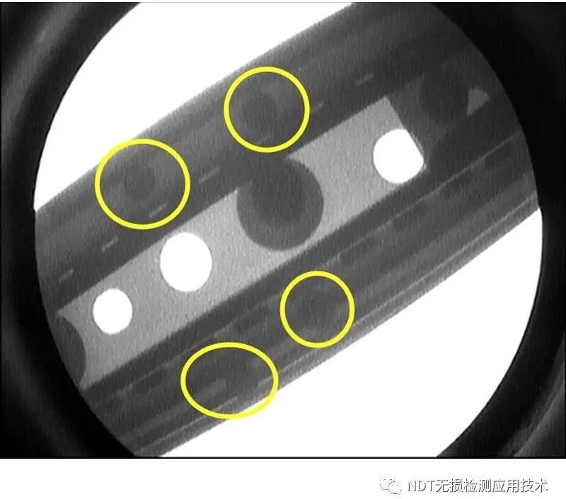 为什么x光片用胶片传统X光胶片成像和X射线数字成像的区别_https://www.jmylbn.com_新闻资讯_第4张