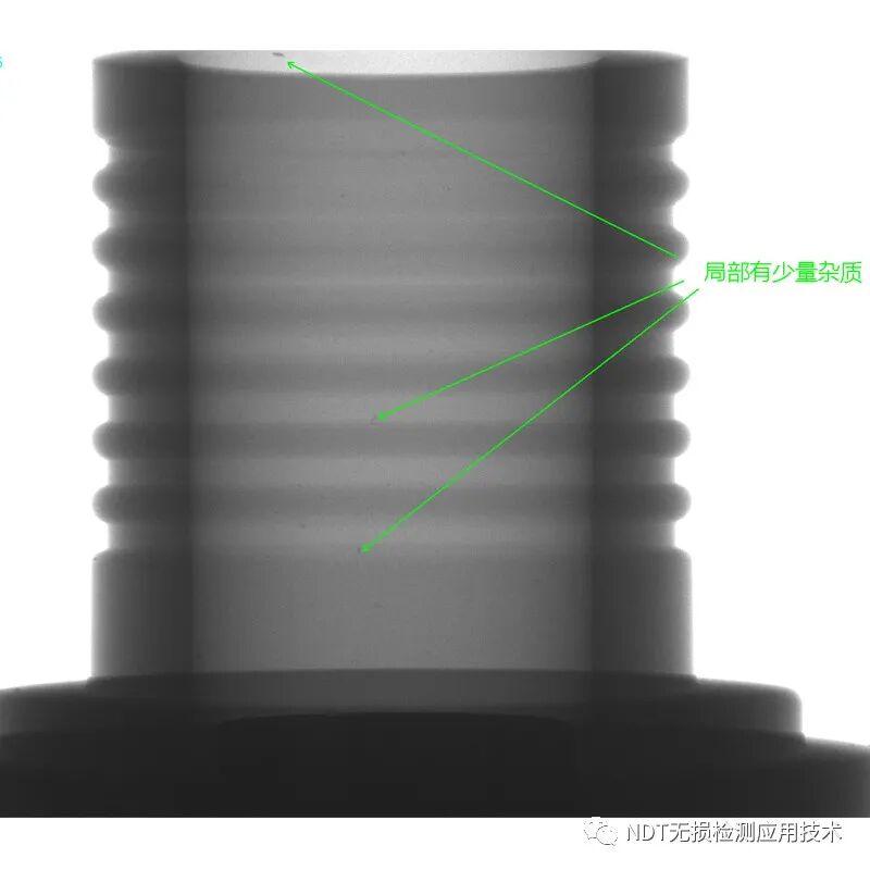 为什么x光片用胶片传统X光胶片成像和X射线数字成像的区别_https://www.jmylbn.com_新闻资讯_第12张