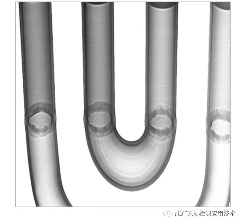 为什么x光片用胶片传统X光胶片成像和X射线数字成像的区别_https://www.jmylbn.com_新闻资讯_第18张