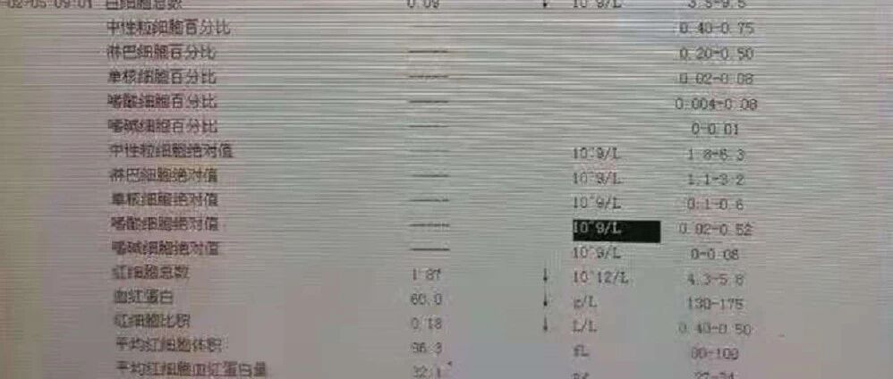 急髓白血病三疗后复发，通过治疗再次缓解！