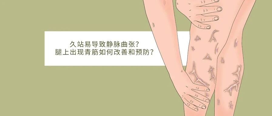 久站易导致静脉曲张？腿上出现青筋如何改善和预防？